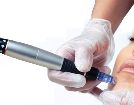 ההדגמה של טיפול בעור בעזרת מכשיר מיקרונידלינג, שבו יד לבושה בכפפה ממגע עם פני אישה.